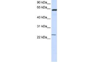 WB Suggested Anti-TMEM138 Antibody Titration:  0. (TMEM138 Antikörper  (N-Term))