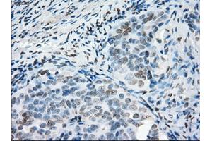 Immunohistochemical staining of paraffin-embedded colon tissue using anti-PRKYmouse monoclonal antibody. (PRKY Antikörper)