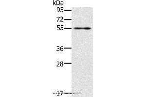 Western blot analysis of Mouse intestinum tenue tissue, using PUS10 Polyclonal Antibody at dilution of 1:200 (PUS10 Antikörper)