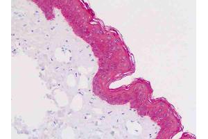 Anti-KRT5 / CK5 / Cytokeratin 5 antibody IHC staining of human skin, epidermis. (Cytokeratin 5 Antikörper  (AA 158-272))
