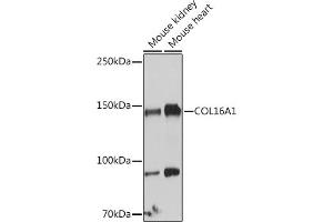 Western blot analysis of extracts of various cell lines, using COL16 antibody (8837) at 1:1000 dilution. (COL16A1 Antikörper  (AA 1000-1100))