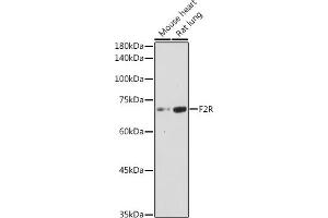Western blot analysis of extracts of various cell lines, using F2R antibody (ABIN6132223, ABIN6140404, ABIN6140405 and ABIN6221279) at 1:1000 dilution. (PAR1 Antikörper  (AA 42-110))