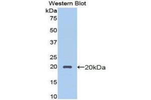 Western Blotting (WB) image for anti-Protein C Receptor, Endothelial (PROCR) (AA 63-205) antibody (ABIN1172000) (PROCR Antikörper  (AA 63-205))