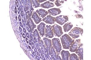 IHC analysis of CCL8 using anti-CCL8 antibody (ABIN6719605).