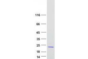 Western Blotting (WB) image for Ras Homolog Enriched in Brain (RHEB) protein (Myc-DYKDDDDK Tag) (ABIN2730840)