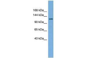 WB Suggested Anti-SEC23IP  Antibody Titration: 0. (SEC23IP Antikörper  (N-Term))