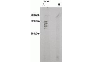 Image no. 1 for anti-Sphingomyelin Synthase 2 (SGMS2) antibody (ABIN793628) (Sphingomyelin Synthase 2 Antikörper)