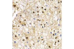 Immunohistochemistry of paraffin-embedded human liver injury using RAD9A antibody. (RAD9A Antikörper)
