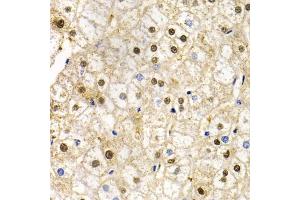 Immunohistochemistry of paraffin-embedded human liver injury using RAD9A antibody. (RAD9A Antikörper)