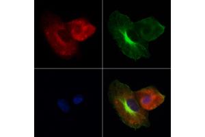 ABIN7094114 and ABIN7098158 staining Hela cells by IF/ICC.