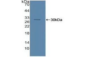 Western blot analysis of recombinant Human ASM. (SMPD1 Antikörper  (AA 319-579))