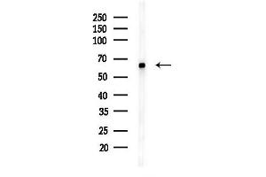 anti-SUMO1/sentrin/SMT3 Specific Peptidase 2 (SENP2) (C-Term) antibody