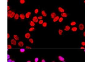 Immunofluorescence analysis of HeLa cells using SFPQ Polyclonal Antibody at dilution of 1:100 (40x lens). (SFPQ Antikörper)