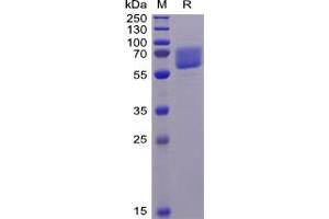 Human AXL Protein, His Tag on SDS-PAGE under reducing condition.