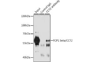 Immunoprecipitation analysis of 200 μg extracts of A-549 cells, using 3 μg TCP1 beta/TCP1 beta/CCT2 antibody (ABIN6128981, ABIN6138104, ABIN6138105 and ABIN6222212). (CCT2 Antikörper  (AA 206-535))