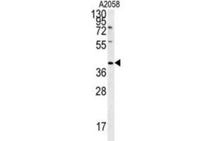 Western Blotting (WB) image for anti-CD99 Molecule-Like 2 (CD99L2) antibody (ABIN3002368) (CD99L2 Antikörper)
