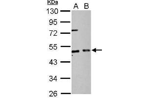 Western Blotting (WB) image for anti-Eukaryotic Translation Initiation Factor 2, Subunit 2 Beta, 38kDa (EIF2S2) antibody (ABIN2856393)
