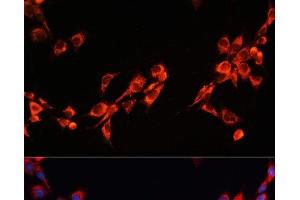 Immunofluorescence analysis of NIH/3T3 cells using PGRMC2 Polyclonal Antibody at dilution of 1:100. (PGRMC2 Antikörper)