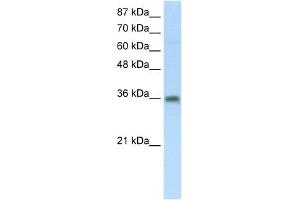 WB Suggested Anti-SFRS10 Antibody Titration:  5. (TRA2B Antikörper  (Middle Region))