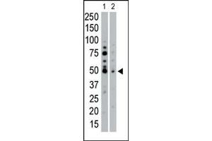 The anti-SGK2 Pab (ABIN1882131 and ABIN2842048) is used in Western blot to detect SGK2 in HeLa cell lysate (Lane 1) and mouse pancreas tissue lysate (Lane 2).