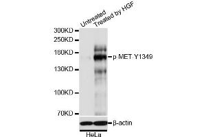 Immunofluorescence analysis of U2OS cells using Phospho-MET-Y1349 antibody (ABIN5969922). (c-MET Antikörper  (pTyr1349))