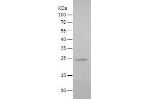 ERG Protein (AA 290-486) (His tag)