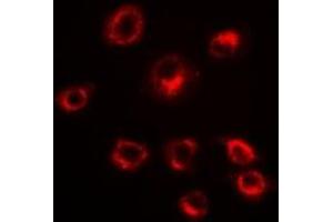 Immunofluorescent analysis of Serpin A10 staining in HepG2 cells. (SERPINA10 Antikörper)