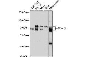 Western blot analysis of extracts of various cell lines, using PICALM antibody (ABIN6132898, ABIN6145606, ABIN6145607 and ABIN6214874) at 1:1000 dilution. (PICALM Antikörper  (AA 290-460))