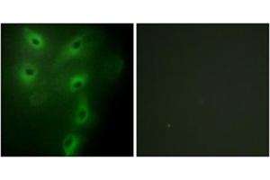 Immunofluorescence analysis of HeLa cells, using TRIM59 Antibody . (TRIM59 Antikörper  (Internal Region))