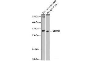 Western blot analysis of extracts of various cell lines using STMN4 Polyclonal Antibody at dilution of 1:1000. (STMN4 Antikörper)