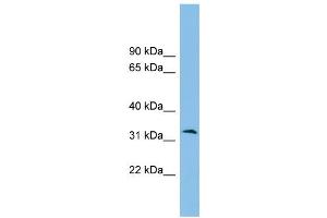 WB Suggested Anti-ZPBP2 Antibody Titration: 0. (ZPBP2 Antikörper  (Middle Region))