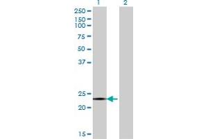 Western Blot analysis of CITED4 expression in transfected 293T cell line by CITED4 monoclonal antibody (M08), clone 4F6. (CITED4 Antikörper  (AA 131-184))