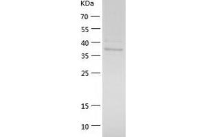 Western Blotting (WB) image for Alcohol Dehydrogenase 5 (Class III), chi Polypeptide (ADH5) (AA 1-374) protein (His tag) (ABIN7121768)