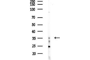 Western blot analysis of lysates from HUVEC cells(LPS,4h treatment), using SNAPC3 Antibody at 1/1000 dilution.