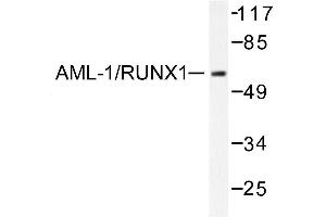 Image no. 1 for anti-Runt-Related Transcription Factor 1 (RUNX1) antibody (ABIN271868) (RUNX1 Antikörper)