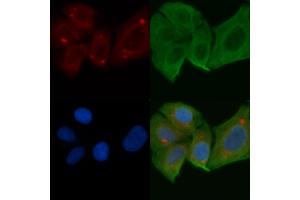 ABIN6258281 and ABIN6275236 staining Hela cells by IF/ICC.