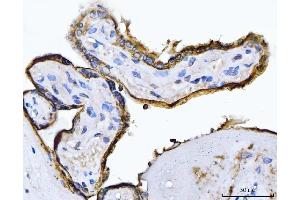 IHC analysis of ALPP using anti-ALPP antibody (ABIN7602772). (PLAP Antikörper  (C-Term))