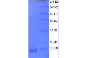 SDS-PAGE (SDS) image for GRO alpha Protein (GRO-A) (AA 35-107) protein (His tag) (ABIN5712451)
