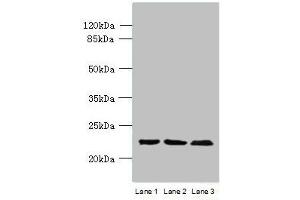 Western blot All lanes: WDYHV1 antibody at 6 μg/mL Lane 1: Mouse heart tissue Lane 2: MCF-7 whole cell lysate Lane 3: U251 whole cell lysate Secondary Goat polyclonal to Rabbit IgG at 1/10000 dilution Predicted band size: 24, 17 kDa Observed band size: 24 kDa (WDYHV1 Antikörper  (N-Term))