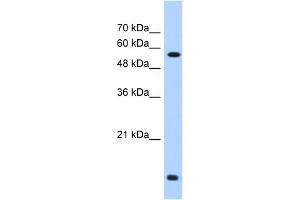 WB Suggested Anti-P4HB Antibody Titration:  0. (P4HB Antikörper  (C-Term))