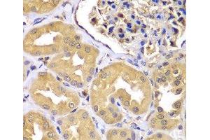 Immunohistochemistry of paraffin-embedded Human kidney using LZTR1 Polyclonal Antibody at dilution of 1:100 (40x lens). (LZTR1 Antikörper)