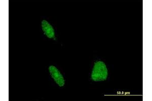 Immunofluorescence of monoclonal antibody to ERCC1 on HeLa cell. (ERCC1 Antikörper  (AA 207-281))