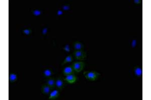 Immunofluorescent analysis of A431 cells using ABIN7173806 at dilution of 1:100 and Alexa Fluor 488-congugated AffiniPure Goat Anti-Rabbit IgG(H+L) (TNFSF14 Antikörper  (AA 1-239))
