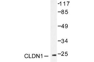 Image no. 1 for anti-Claudin 1 (CLDN1) antibody (ABIN265358) (Claudin 1 Antikörper)