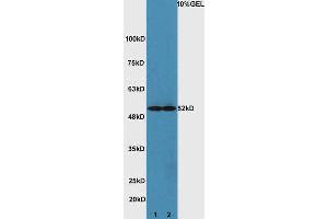 Lane 1: mouse heart lysates Lane 2: mouse brain lysate probed with Rabbit Anti-ATG4D Polyclonal Antibody, Unconjugated (ABIN752473) at 1:300 overnight at 4 °C. (ATG4D Antikörper  (AA 381-474))