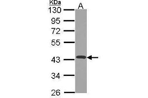 WB Image Sample (30 ug of whole cell lysate) A: JurKat 10% SDS PAGE antibody diluted at 1:1000 (NDUFA10 Antikörper  (Center))