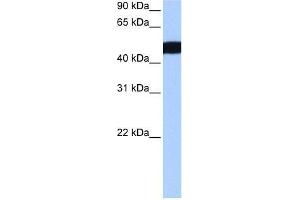 Western Blot showing CROCCL2 antibody used at a concentration of 1-2 ug/ml to detect its target protein. (CROCCP3 Antikörper  (N-Term))