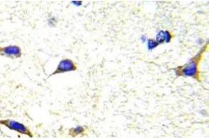 Immunohistochemistry (IHC) analyzes of LIMK1/2 antibody in paraffin-embedded human brain tissue. (LIM Domain Kinase 1 Antikörper)