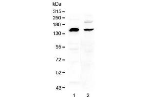 Western blot testing of human 1) U-87 MG and 2) MDA-MB-453 cell lysate with NEDD4 antibody at 0.