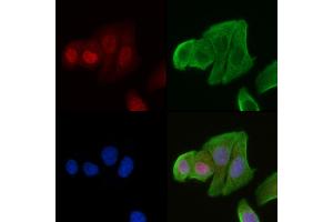 ABIN6265292 and ABIN6278636 staining Hela cells(30 min of UV treatment) by IF/ICC. (SRPK3 Antikörper  (Internal Region))